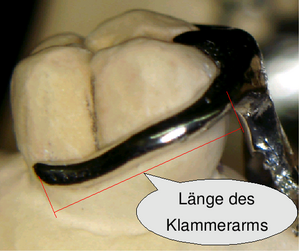 Klammer laenge.png