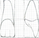 Vorlage eines Zahns in zwei Ansichten