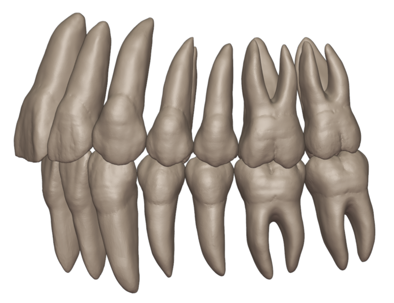 Datei:Zahn zu Zahn bukkal.png